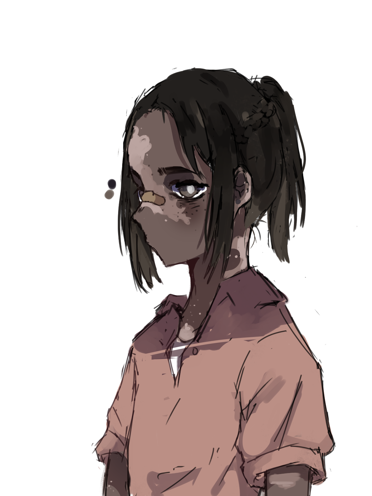 Vitiligo MOMO Illustrations ART street